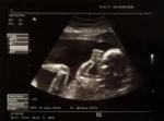 Pierwsze zdjęcie USG Szymka przed narodzeniem